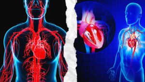 Human Heart